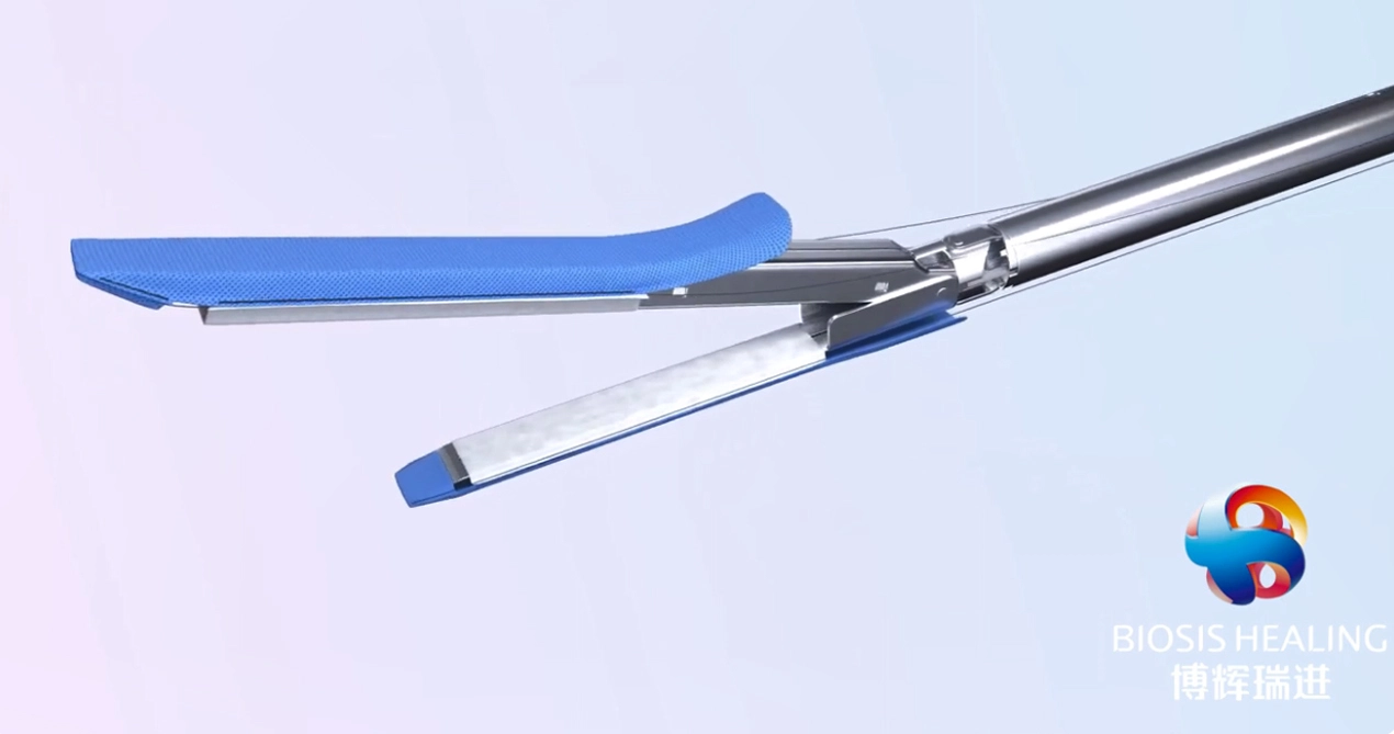 Линия подкрепление штапеля для гастрэктомии рукава для бариатрической хирургии